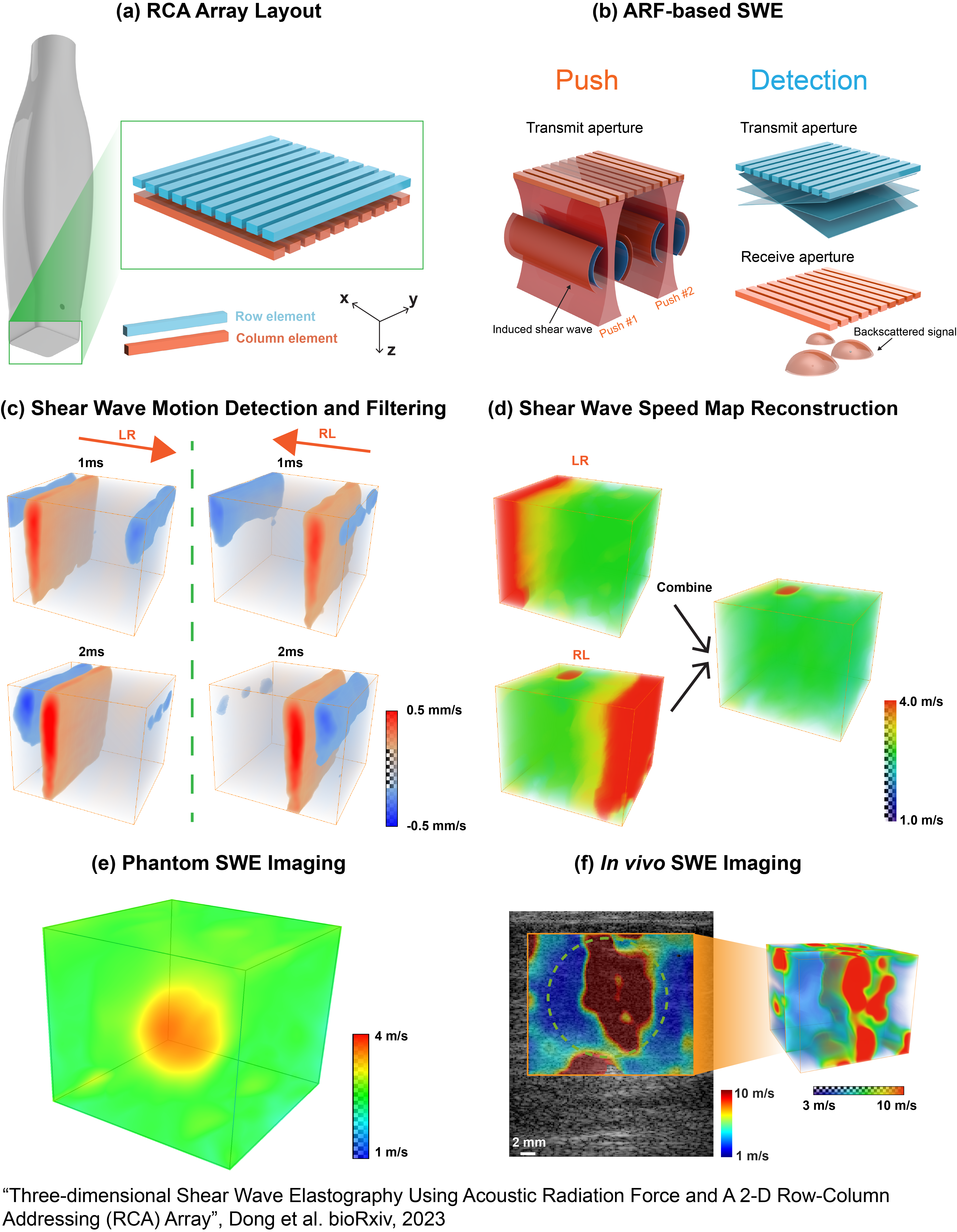 3D ARF-SWE imaging